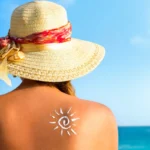Summer Skin Emergencies + What To Do